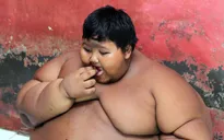 Cảnh báo nguy cơ bùng nổ nạn béo phì trên thế giới