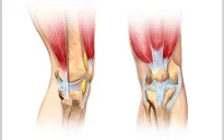 Tư vấn và khám bệnh miễn phí chấn thương dây chằng khớp gối