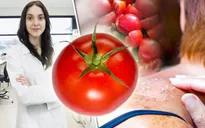 Những thực phẩm giúp chống lại tác hại của tia UV
