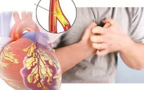 Thanh niên 17 tuổi ngừng tuần hoàn sau khi chạy gắng sức