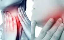 Quan hệ tình dục bằng miệng dễ dẫn tới ung thư vòm họng
