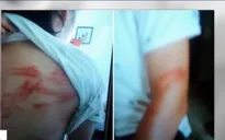 Đâu là ranh giới giữa "yêu cho roi cho vọt" với bạo hành?