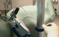 Ca phẫu thuật mắt đầu tiên trên thế giới sử dụng cánh tay robot