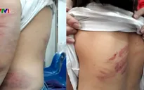Gia tăng trẻ bị bạo hành trong gia đình