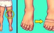 7 dấu hiệu bạn đang ăn quá nhiều muối