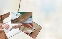 Bỏ trống việc trang bị kĩ năng phòng chống bệnh dại ở cơ sở