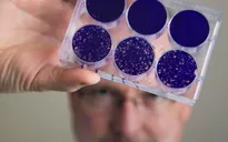 Virus bại liệt mang lại hy vọng mới chữa khỏi ung thư não