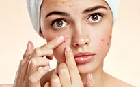 Mách bạn cách chăm sóc da cực kỳ đơn giản lại không tốn kém