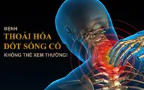 Nguy cơ bại liệt từ bệnh lý thoái hóa đốt sống cổ