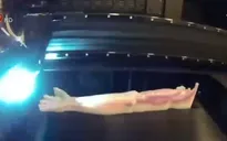 Brazil: Bộ phận cơ thể nhân tạo in 3D