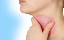 Thuốc lá, rượu - Nguyên nhân chính làm tăng nguy cơ mắc ung thư thanh quản