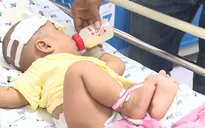 TP.HCM: Cảnh báo bệnh viêm màng não mủ ở trẻ gia tăng