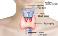 11 triệu chứng của bệnh tuyến giáp không ngờ tới