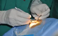 Hai bé trai được ghép giác mạc của Vân Nhi