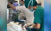 TP.HCM phẫu thuật tim cho bé sinh non