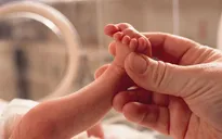 Những điều cần biết khi chăm sóc trẻ sinh non