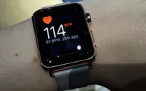 Phát hiện nhịp tim bất thường nhờ đồng hồ Apple Watch