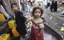 Trẻ em Yemen bị suy dinh dưỡng nghiêm trọng