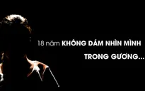 Hành trình tìm lại nụ cười của cô gái "ma cà rồng"