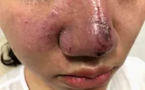 Hà Nội tăng cường kiểm tra, xử lý hoạt động của các cơ sở dịch vụ thẩm mỹ