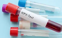 Nhiễm HPV - Nguyên nhân chính gây ung thư cổ tử cung