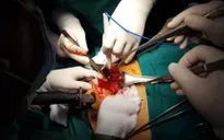 Bệnh nhân vào viện với cây dao còn cắm trên ngực