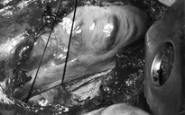 Mắc ung thư phổi giai đoạn cuối vì tin tưởng điều trị bằng thuốc lá