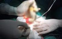 Vòi xịt nước dài 45cm mắc kẹt trong hậu môn nam thanh niên