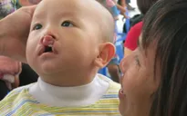 Quyên góp giúp đỡ trẻ em khuyết tật