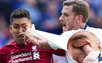 Cận cảnh pha "móc mắt" ghê rợn trong trận Tottenham - Liverpool