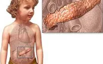 Bệnh viêm tụy ở trẻ: nguy hiểm khó lường!