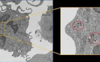 Virus có triển vọng mới trong điều trị ung thư