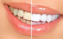Tự làm kem đánh răng siêu trắng trong tích tắc tại nhà