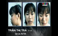 Change Life 2018: Cô sinh viên trường y tự tin sau phẫu thuật thẩm mĩ