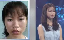 Cô sinh viên trường ĐH Y Hà Nội xinh như búp bê sau phẫu thuật thẩm mỹ