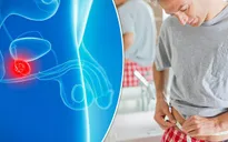 Triệu chứng cảnh báo ung thư tuyến tiền liệt giai đoạn đầu