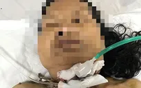 Cụ bà bị đứt khí quản do ngã vào dao mổ gà