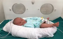 Lào Cai: Các bác sĩ cứu sống thành công hàng chục trẻ sinh non ở huyện biên giới