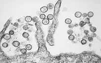 Dịch virus Hanta lây lan tại Argentina khiến 9 người thiệt mạng