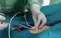 Nghệ An: Cứu sống bệnh nhân sốc tim, sốc nhiễm khuẩn nặng