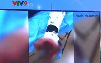 Vừa sạc vừa dùng điện thoại, thiếu niên 17 tuổi bị nát bàn tay