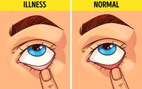 Một số mẹo đơn giản để biết tình trạng sức khỏe của bạn