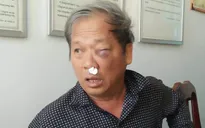 Hội Nhà báo Việt Nam đề nghị bảo vệ phóng viên khi tác nghiệp