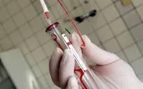 Hơn 14.000 bệnh nhân HIV ở Singapore bị lộ thông tin