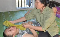 Bị ấu trùng giun đũa chó, người đàn bà khốn khổ không được đi viện vì phải ở nhà chăm 2 em thần kinh
