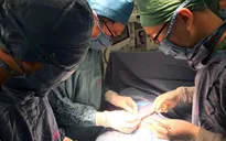 Tắc tá tràng bẩm sinh, bé trai 11 ngày tuổi bị đứt rời tá tràng thành hai đoạn