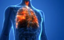 Mỹ đặt tên cho căn bệnh viêm phổi do thuốc lá điện tử gây ra