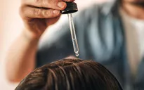 Bỏ túi 8 bí kíp ngăn ngừa gàu hiệu quả trong mùa hanh khô