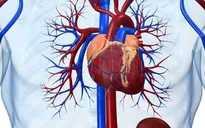 Viêm cơ tim cấp - Một số điều bệnh nhân cần biết