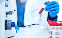 Phương pháp mới giúp phát hiện biến chứng tiểu đường nhanh và chính xác hơn